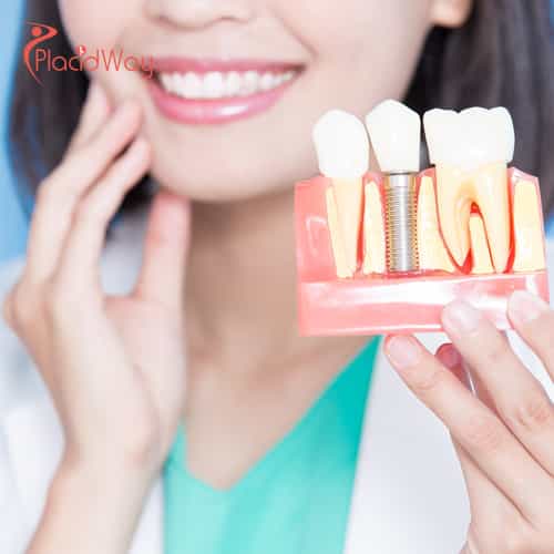 Escaping High Dental Costs: How UK Patients Are Saving Thousands on Implants in Georgia